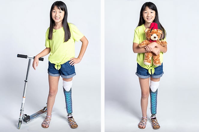 a side by side image of the same young girl. The left she is with a standing scooter, the right she is holding a teddy bear wearing a fez