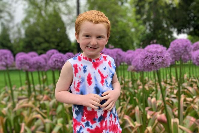 cleft lip patient Beau outside, surrounded by flowers
