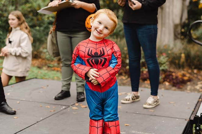cleft palate patient Beau wearing costume