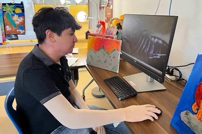 a teenager with a compression sleeve on his harm and hand sitting in front of a computer