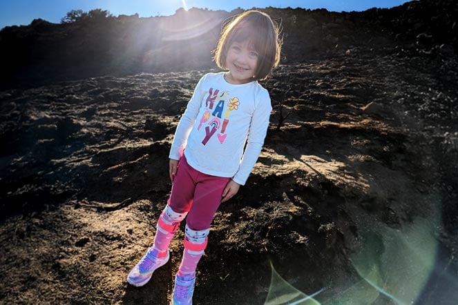 female casting patient outside