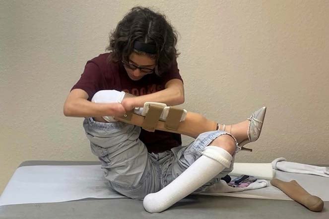 Grace putting on high heel prosthetic legs