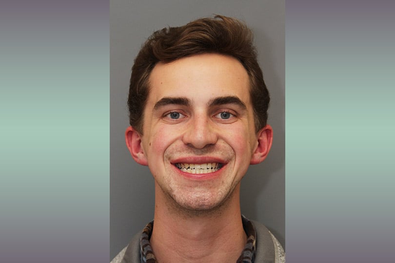 Graham smiling big after surgery