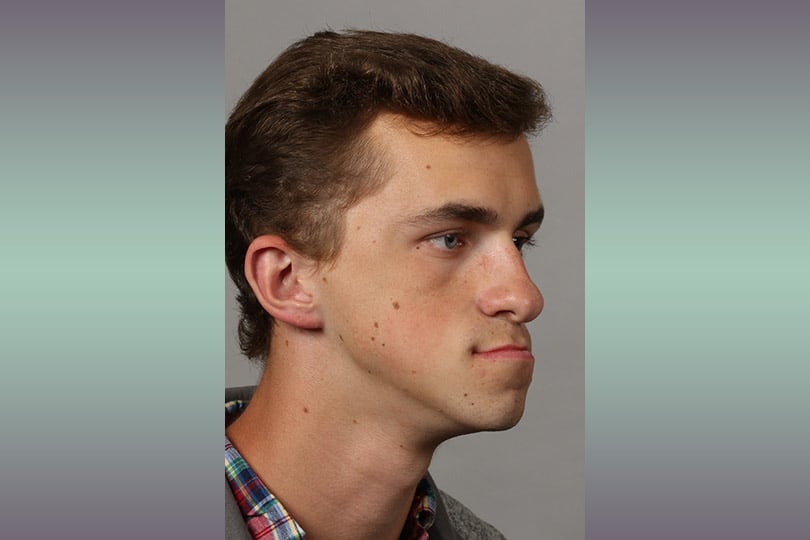 Graham before surgery