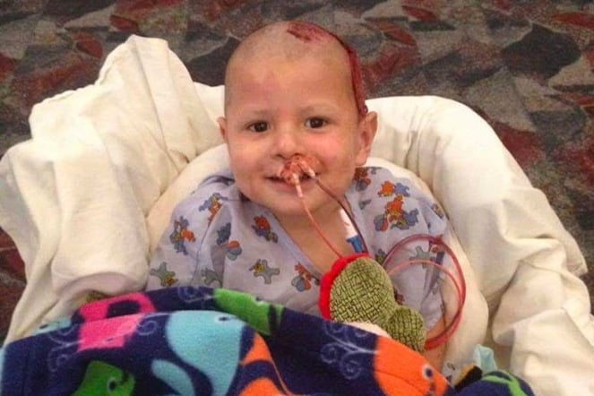 a smiling infant with burn injuries on his head