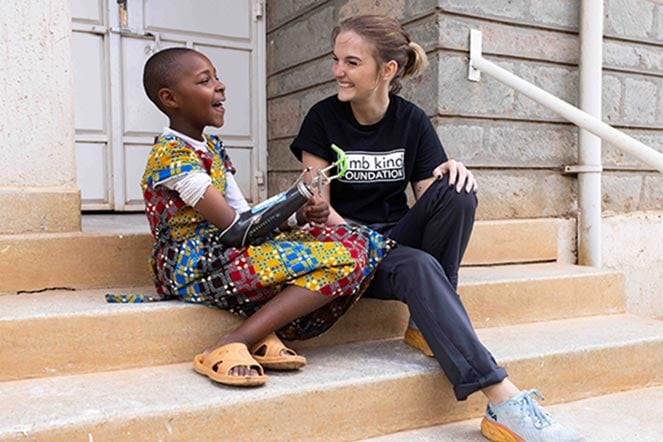 Keegan laughing with prosthetic patient