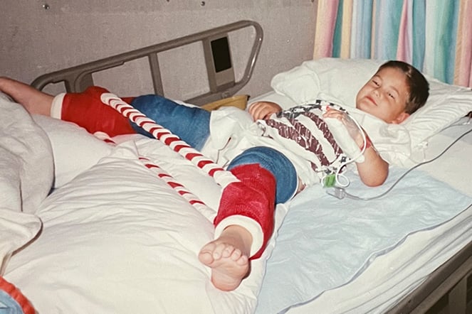 a smiling child in a hospital bed wearing leg casts