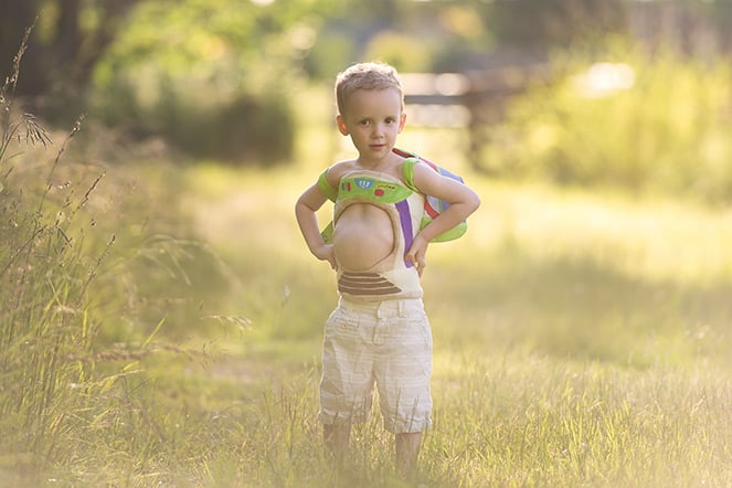 Liam wearing Buzz Lightyear scoliosis brace