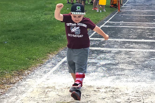 a child with a prosthetic leg jumping into sand