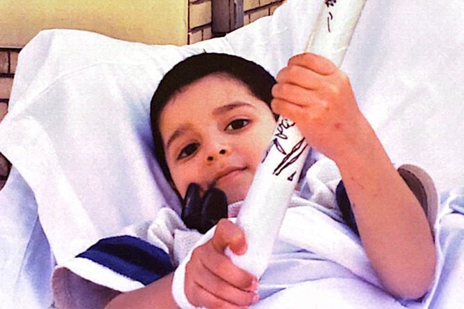 limb length discrepancy patient smiling and holding a plastic pole