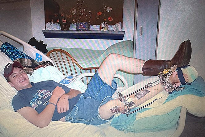 an aged photo of a teenager smiling in bed wearing a cowboy boot and and a leg brace 