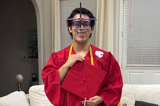 a teenager with a maxillary distractor wearing a graduation gown holding a cap