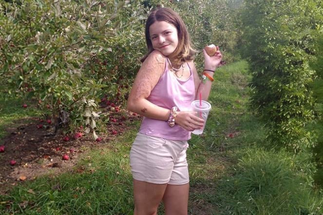 burn patient Nevaeh outside