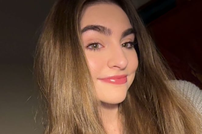 a selfie photo of a orthopedic patient