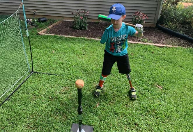 Orthopedic patient with prosthetic