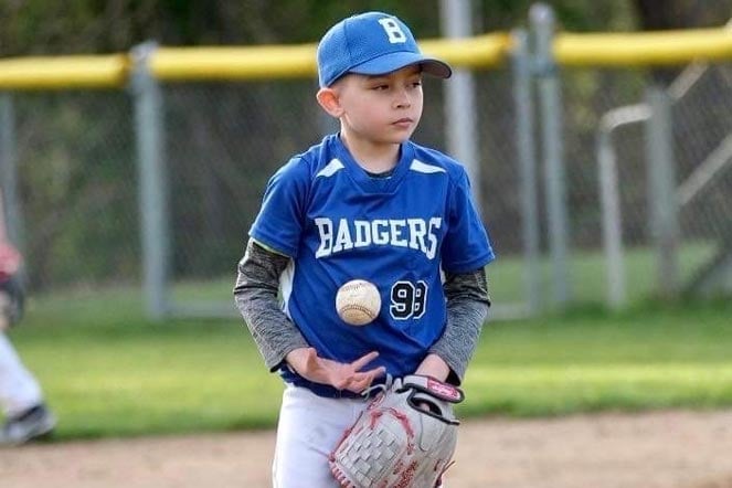 burn patient in uniform playing baseball
