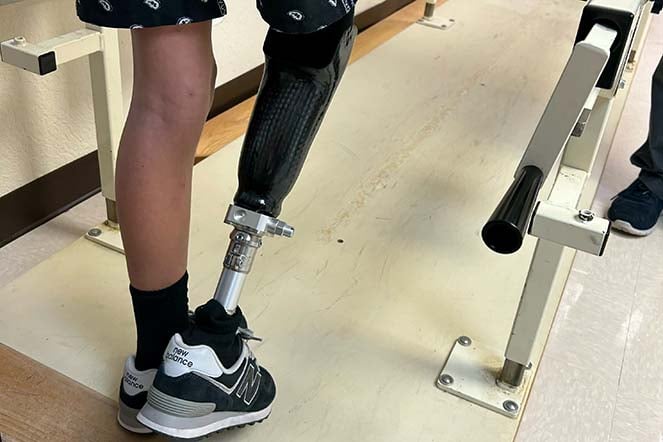 close-up of prosthetic leg