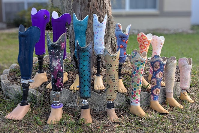 a collection of 15 prosthetic legs arranged in the front lawn of a home. They start large on the left side of the screen and gradually get smaller as they arrange to the right, showing the growth of the person wearing them throughout their childhood.