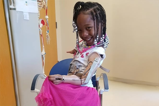 prosthetic patient smiling in a pink tutu while sitting in a chair 