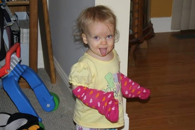 toddler burn patient with hand wraps sticking their tongue out and smiling for the camera