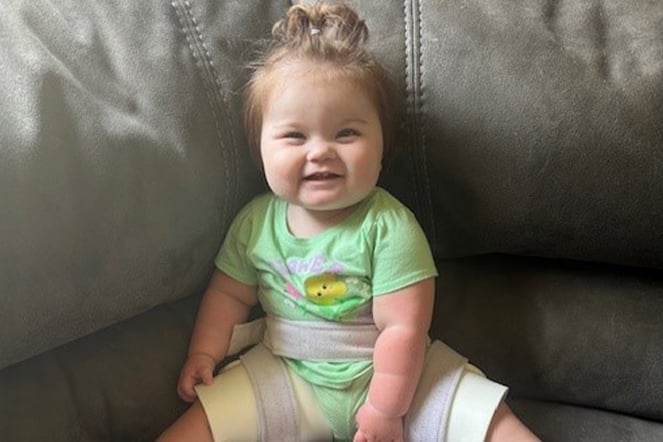 a smiling infant wearing leg braces seated on a couch