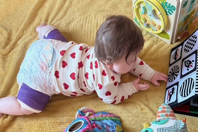 an infant with leg braces lying on her stomach while playing with a matching game