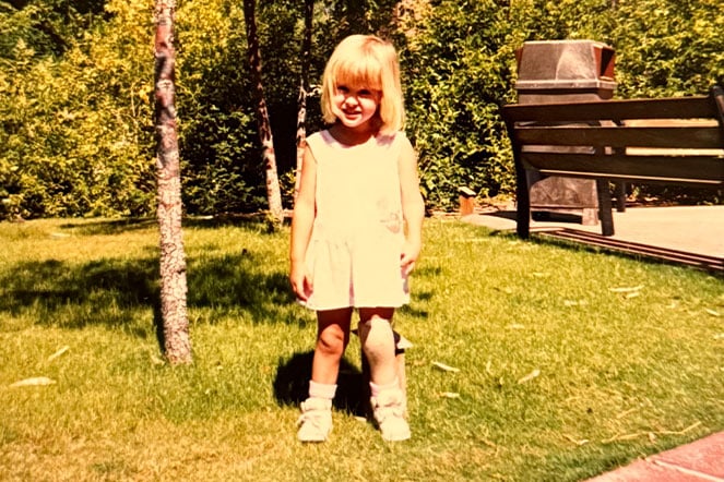 a vintage photo of a child with a prosthetic leg in a park