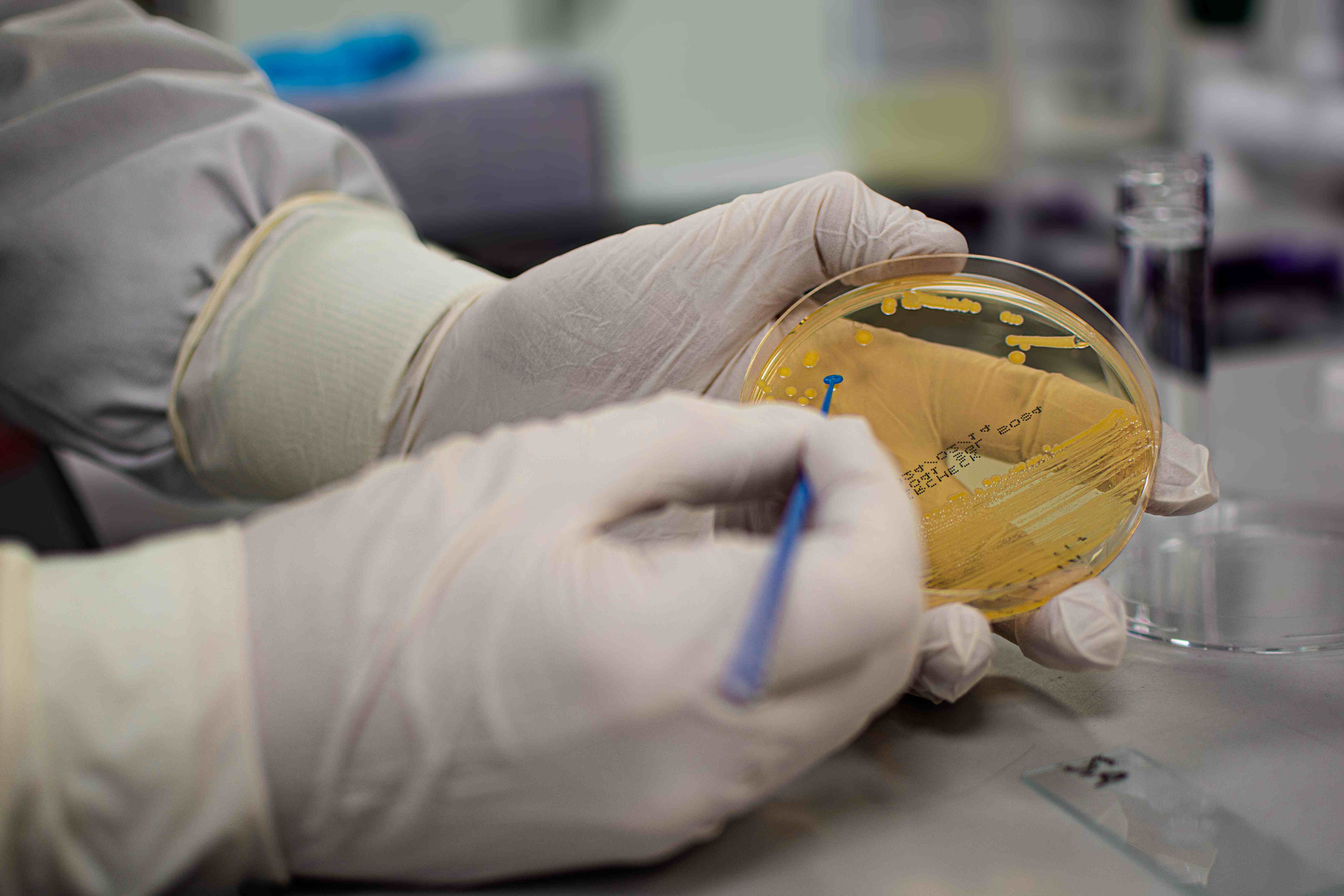 Microbiology Testing Services