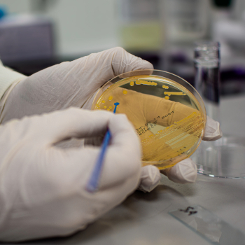 BACTERIAL IDENTIFICATION