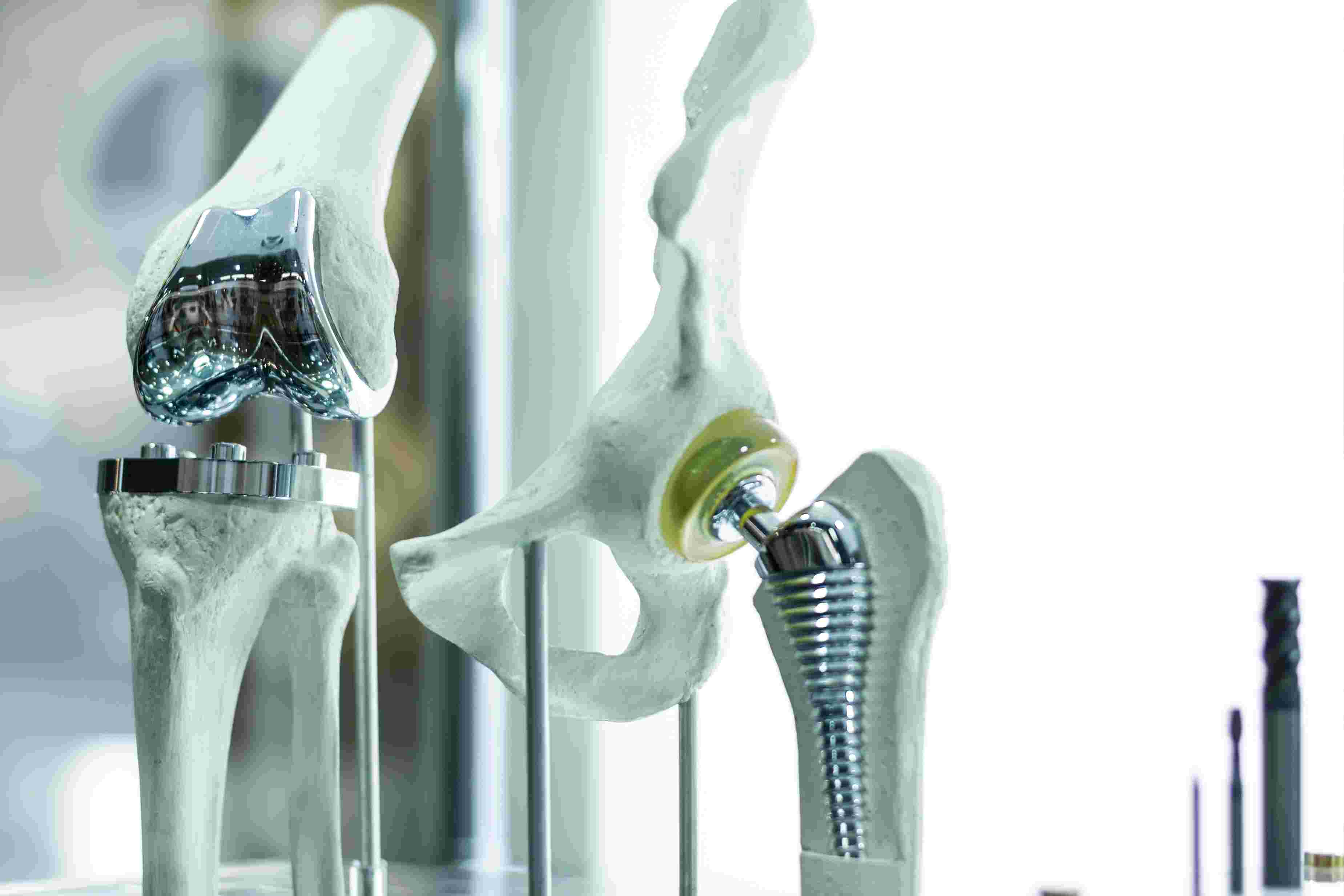 Orthopeadics