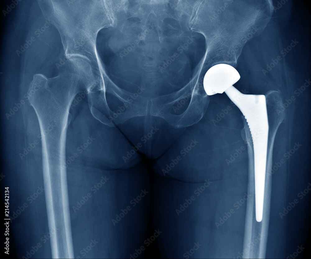 Medical Devices - AdobeStock_214542134_Preview