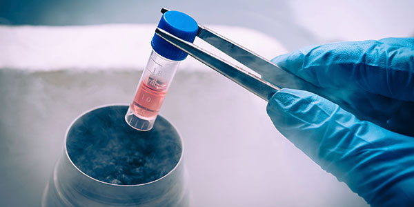 Cryopreservation tube