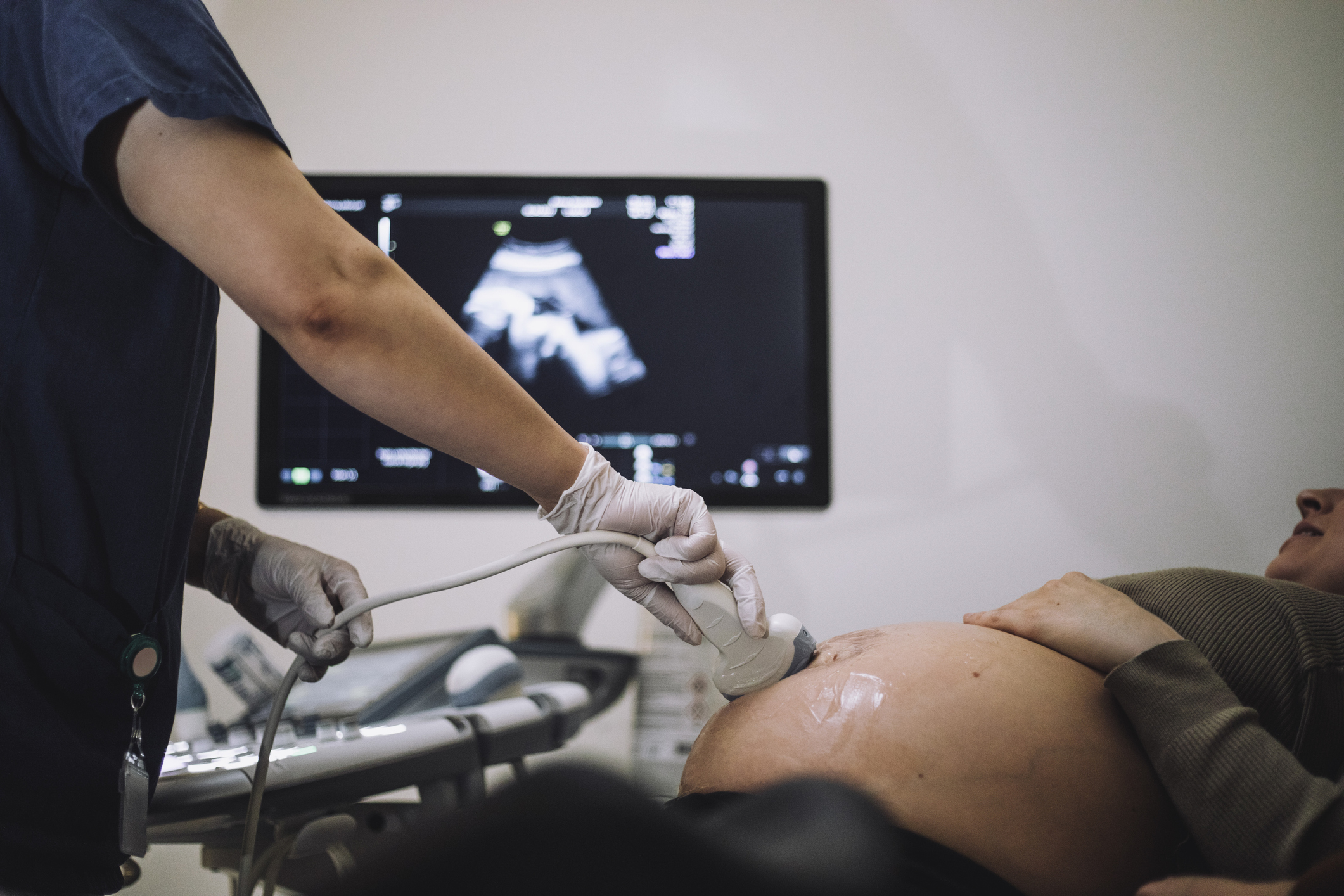 ultrasound-pregnant-woman