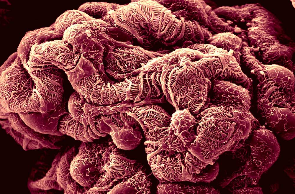 Healthy glomerulus