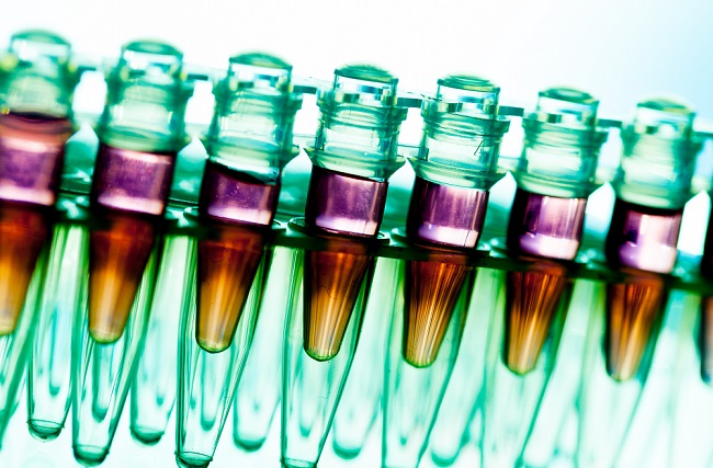 Lab test tube samples