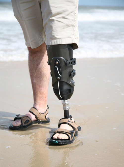 Man with prosthetic leg