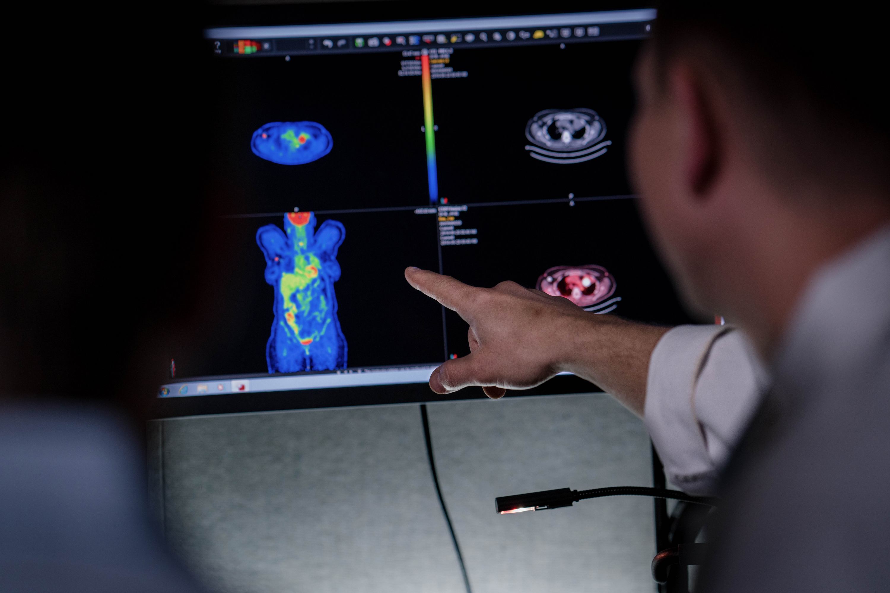 Photo of a fellow examining a  PET scan