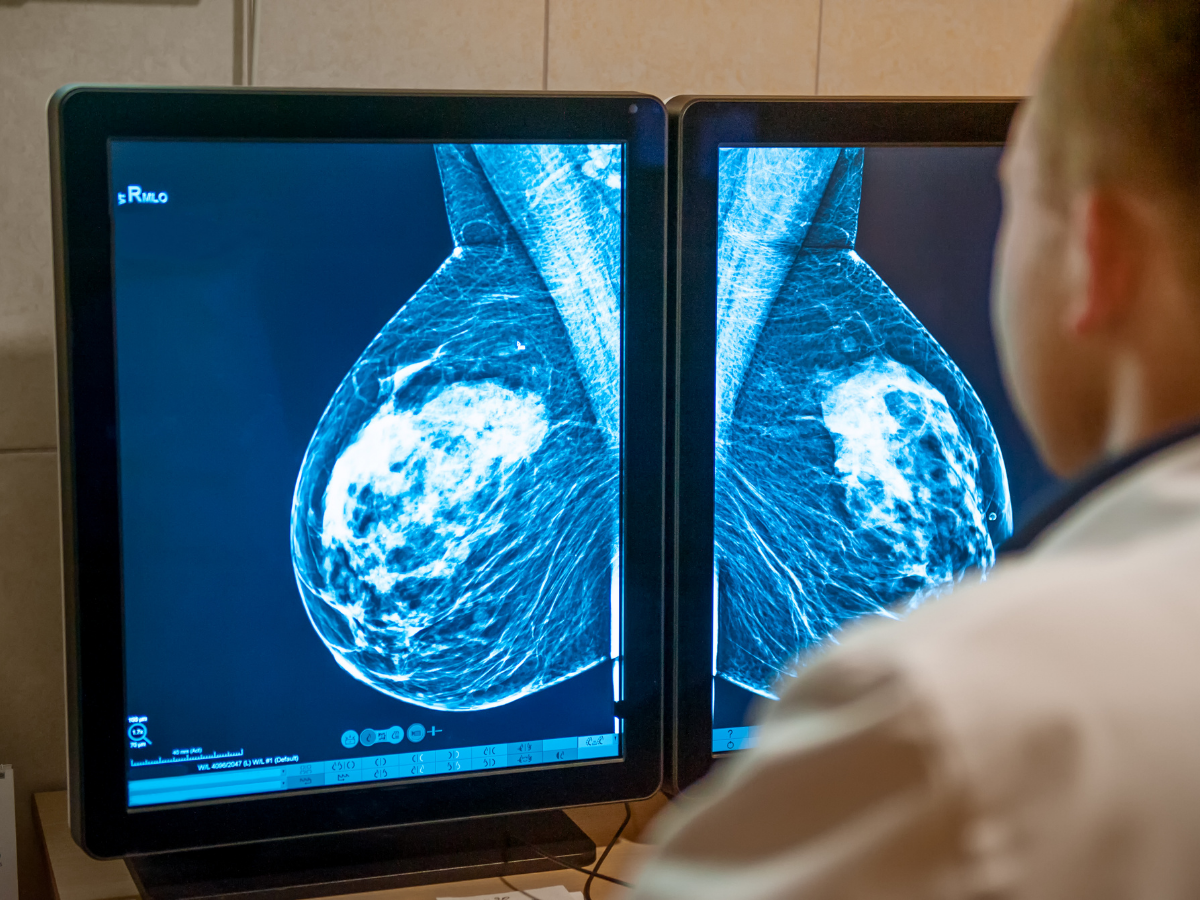 Radiologist reviewing a mammogram