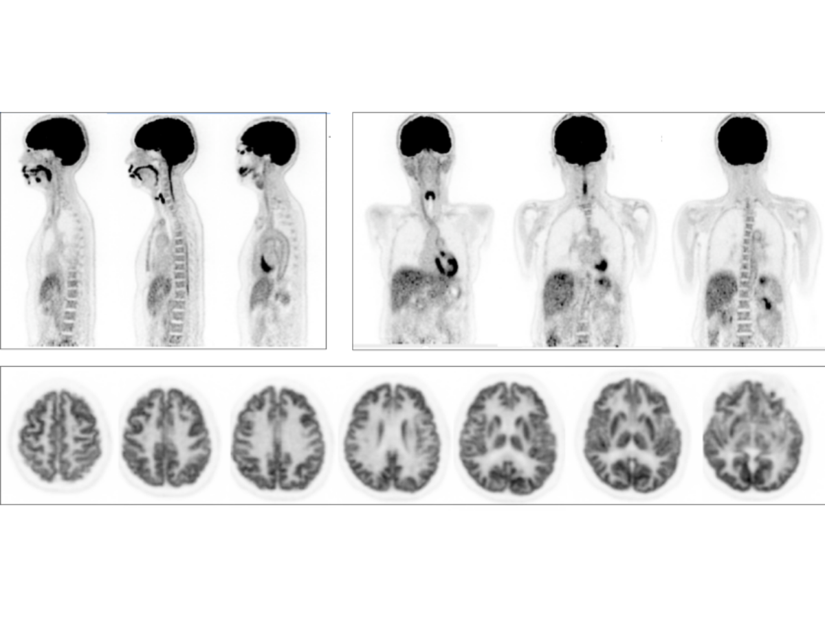 Photo of PET scan