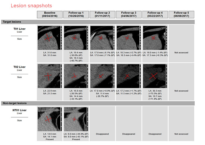 Trac Report: Thumbnail of measured lesions