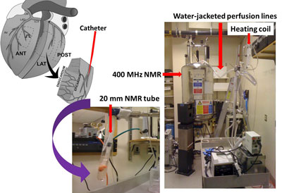 Perfused heart wedges for Carbon-13 NMR-based metabolic studies