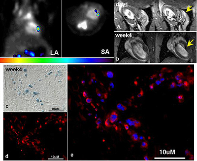 The long (LA) and short (SA) axis view of a rat heart receiving 5 million ESCs