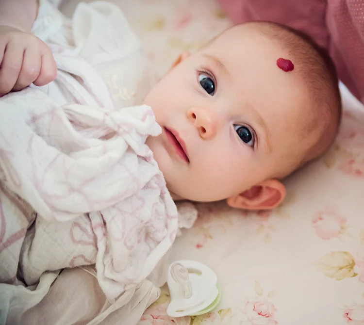 Pediatric Birthmarks & Vascular Anomalies