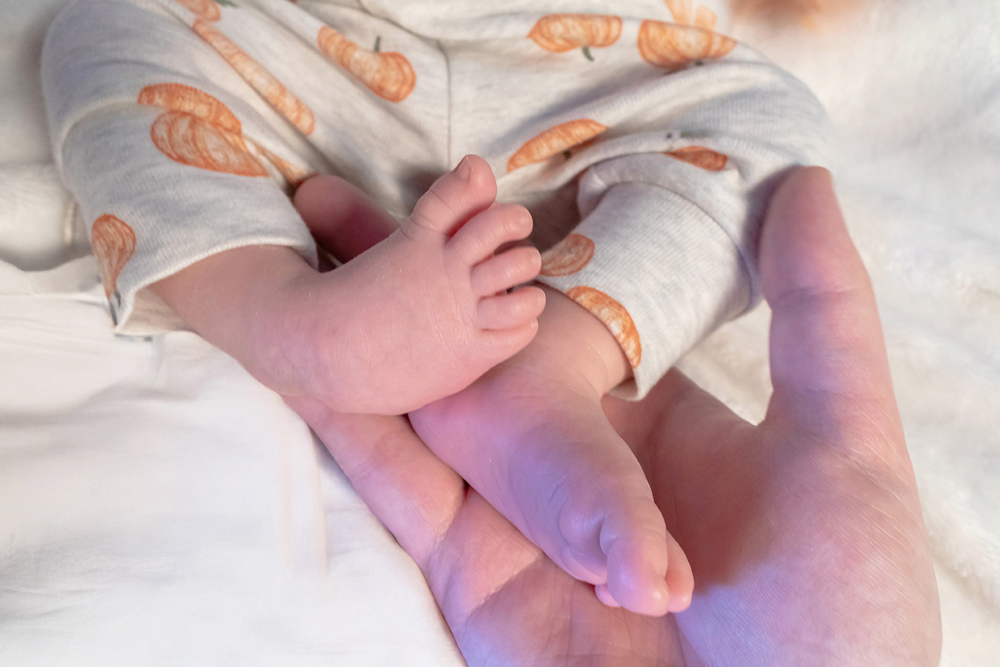 Clubfoot