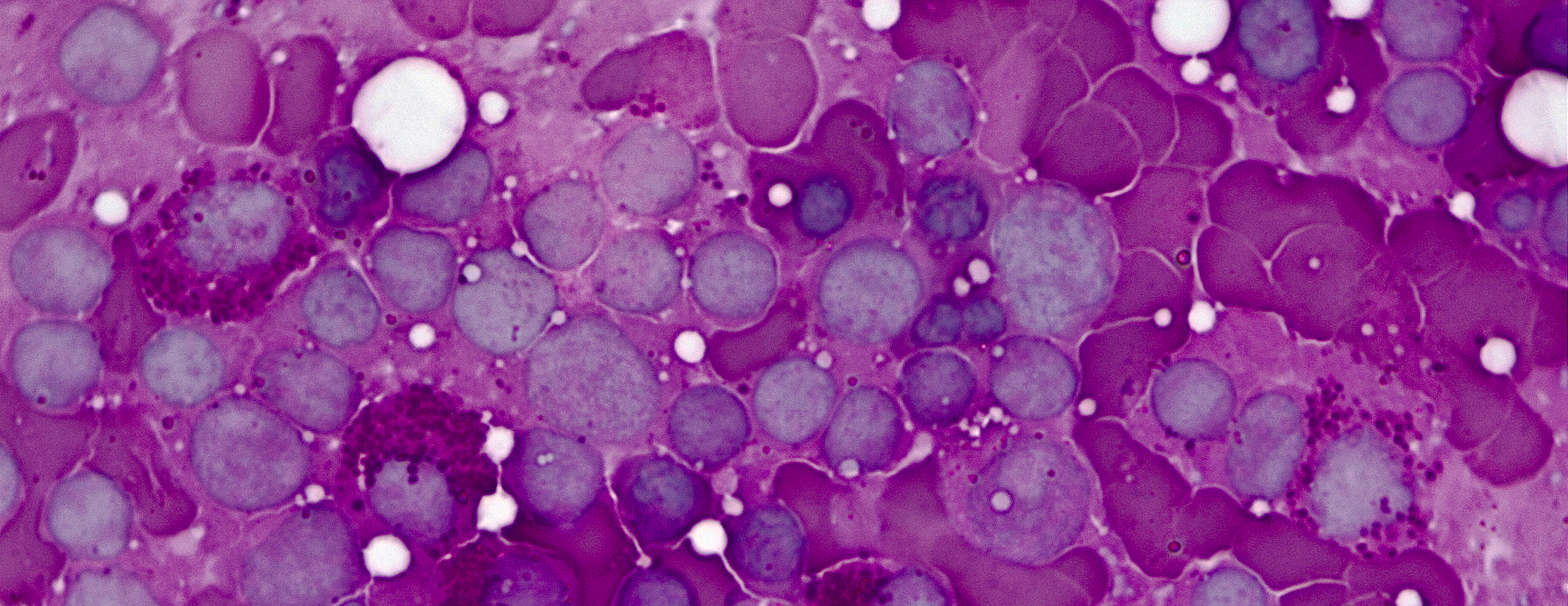 what-is-bone-marrow-2x