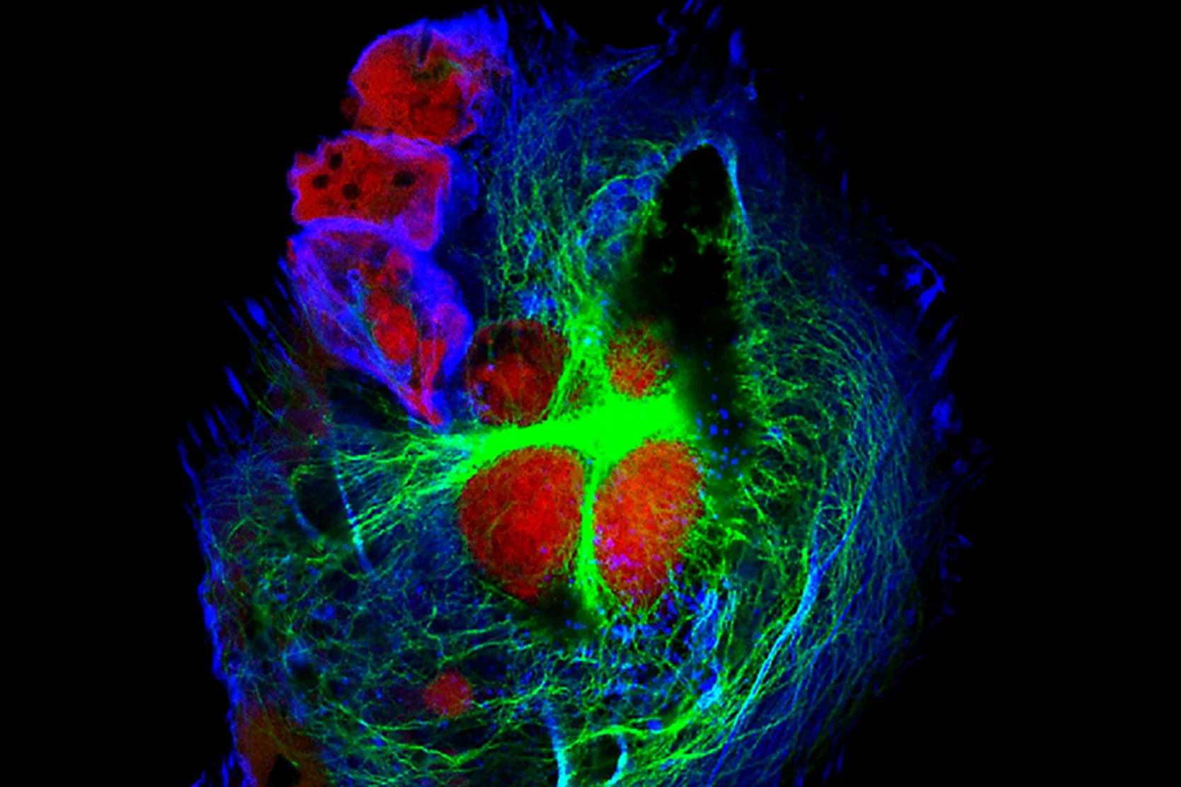 high-risk-neuroblastoma-treatment-options-2x
