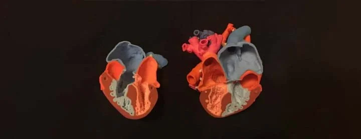 3D printing in medicine
