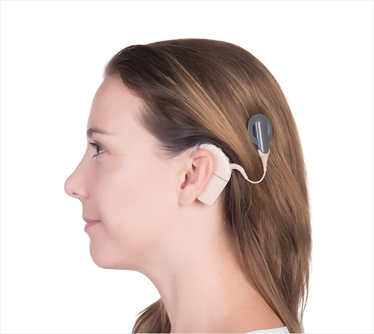 Cochlear Implant