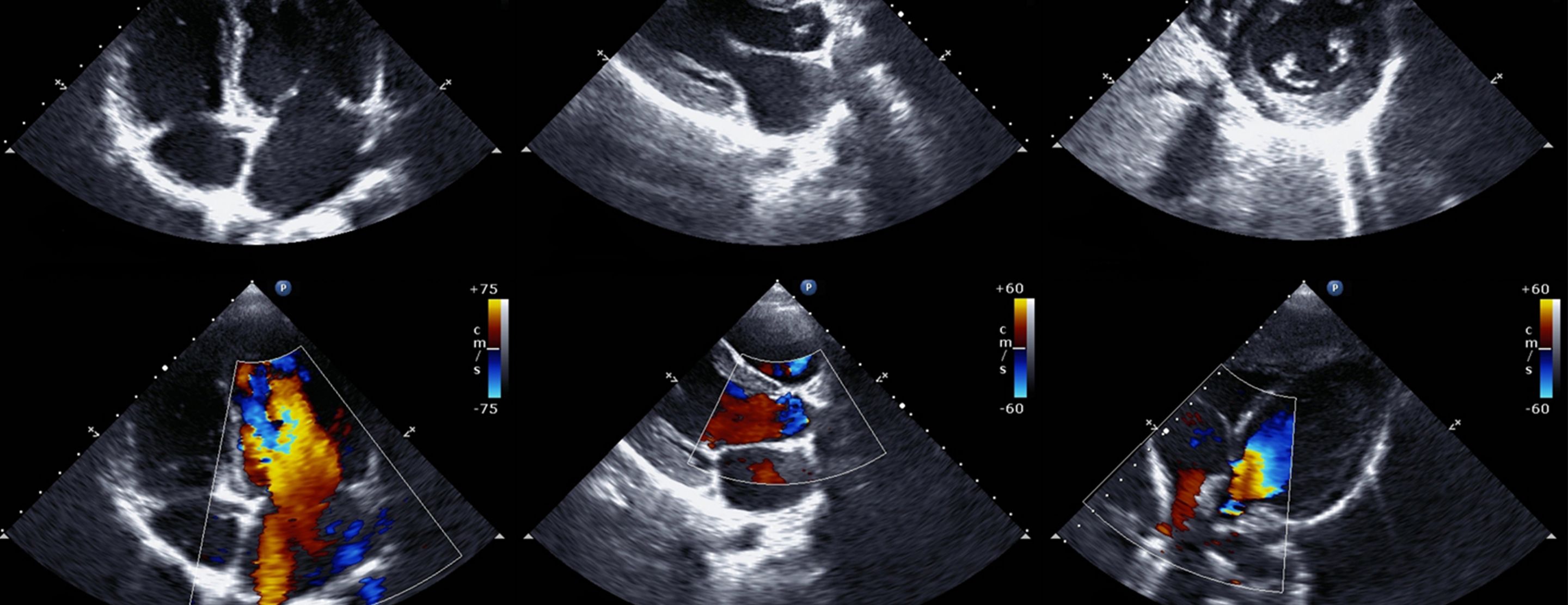 Echocardiogram | UCSF Health