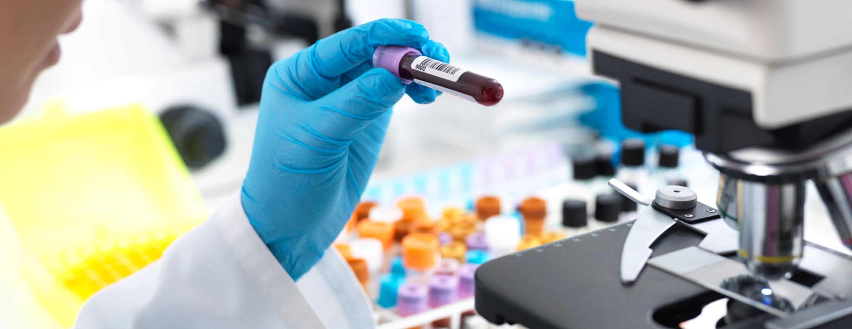 Chloride test - blood | UCSF Health